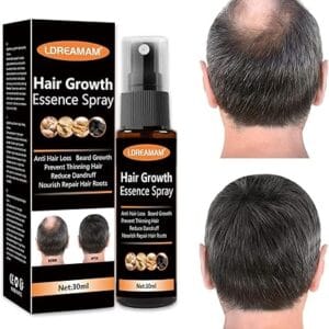 Hair Regrowth Spray - Health & Beauty | BuyersFeast